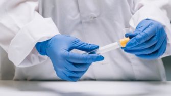 Guatemala recibe 7 mil 500 pruebas para detección de coronavirus