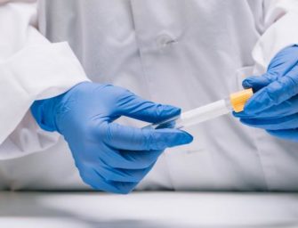 Guatemala recibe 7 mil 500 pruebas para detección de coronavirus