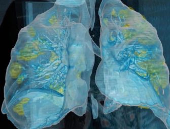 Récord: Guatemala supera los 30 mil casos de coronavirus