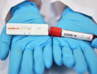 Administración anterior de Salud dejó 12 mil pruebas de Covid-19 sin procesar