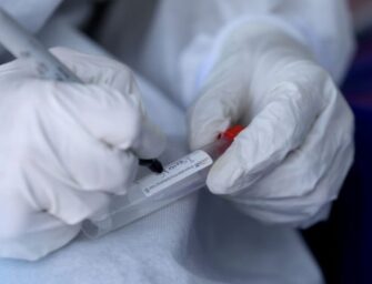 698 nuevos casos de coronavirus al procesar 5 mil pruebas
