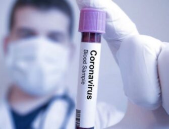Fallecen en Guatemala otras 31 personas a causa del coronavirus