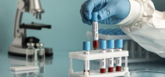 Gobierno aclara que hay al menos un niño entre contagiados con Delta