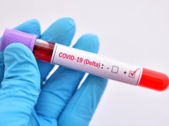 Confirmación de Delta en el país se conocerá en 10 días