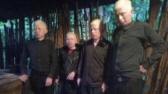 Hermanos albinos comen una vez al día
