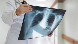 Formas naturales de limpiar tus pulmones
