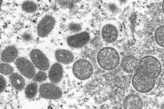 ¿Qué se sabe del tercer caso de Viruela del Mono en el país?