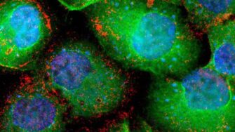 El 30% de todos los cánceres están relacionados con el tabaco