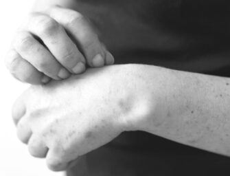 Confirman sexto caso de sarampión; ahora en la capital