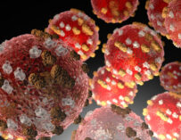 MSPAS reporta 616 casos de sarampión en el país; 26 áreas de salud registran contagios